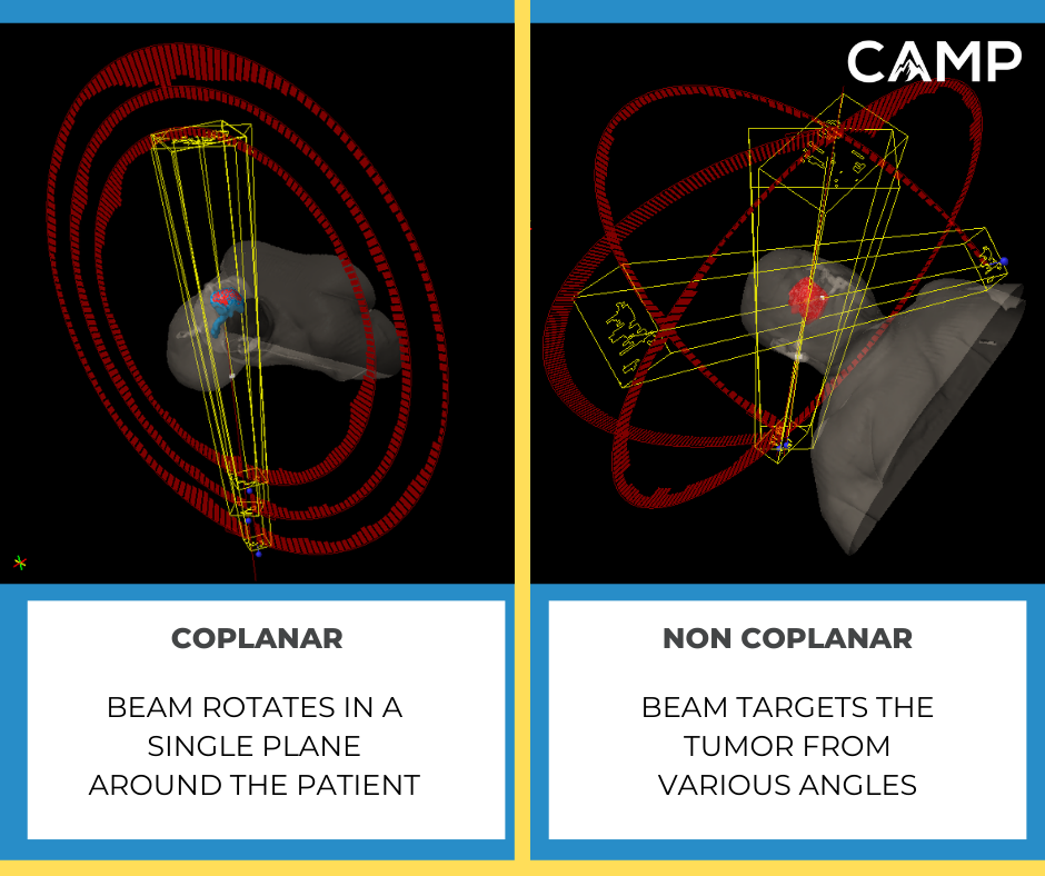 Coplanar-vs.-Non-Coplanar-Fields dosimetry